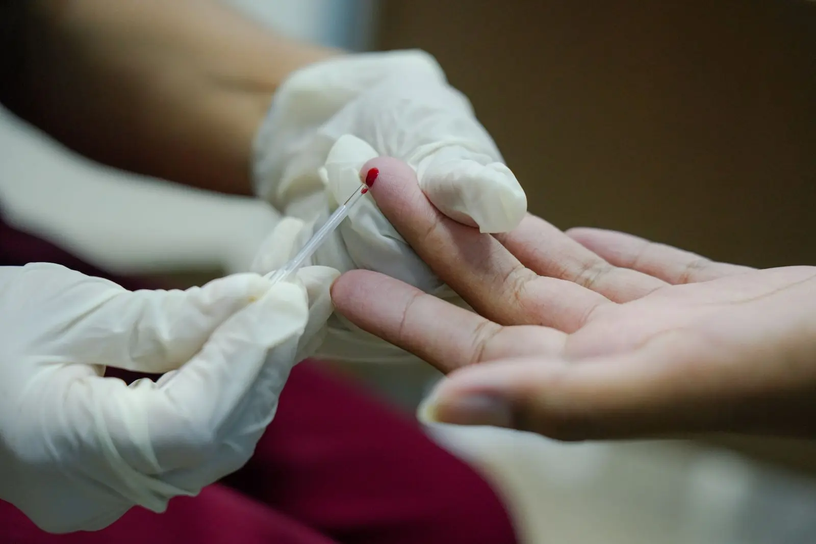 Porto Velho amplia diagnóstico e fortalece ações de enfrentamento às hepatites virais