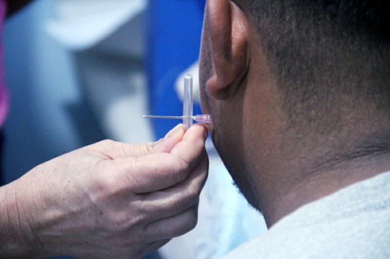 Hanseníase é uma doença infecciosa que afeta principalmente a pele e os nervos periféricos