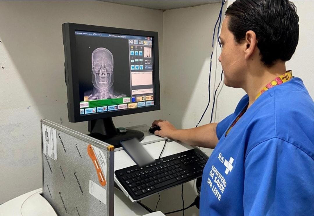 Aparelho de raio-X da zona Leste foi reativado e está sendo utilizado normalmente