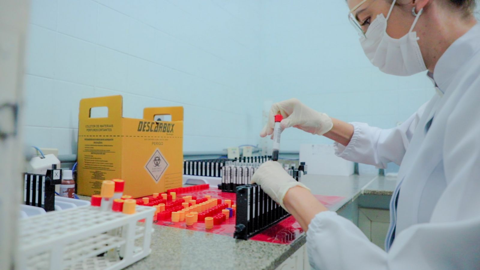 No Laboratório da Semusa são realizados mais de 80 tipos de exames