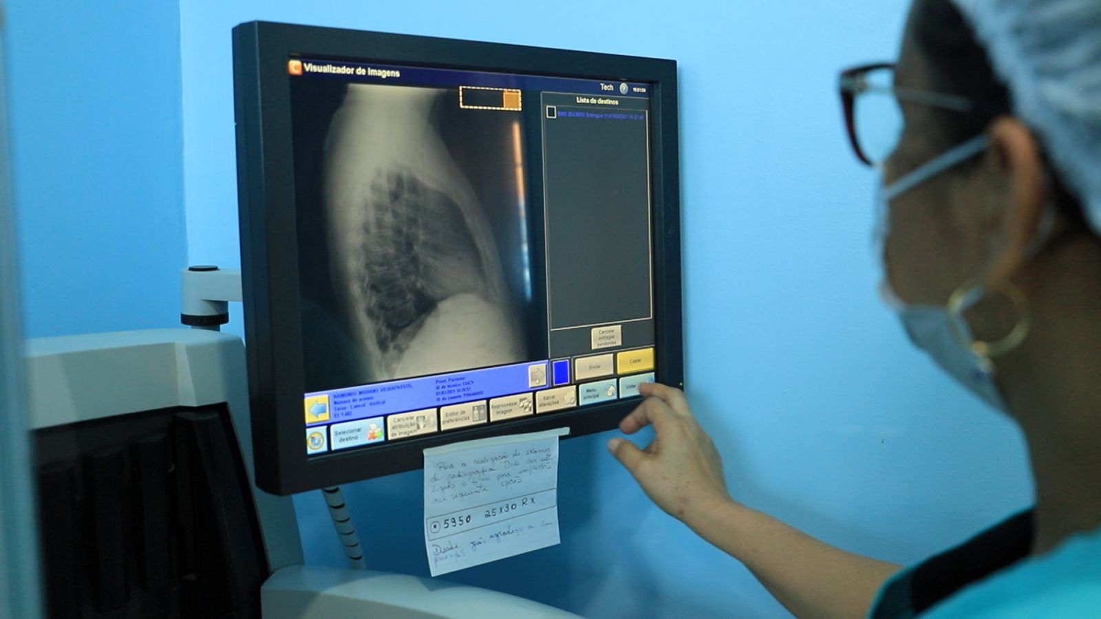 O raio-X, essencial para auxiliar os diagnósticos médicos, estava parado por falta de uma peça específica